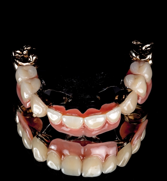 R&V Qualitätszahntechnik - Dentallabor - Anti-Schnarch-Mundstück