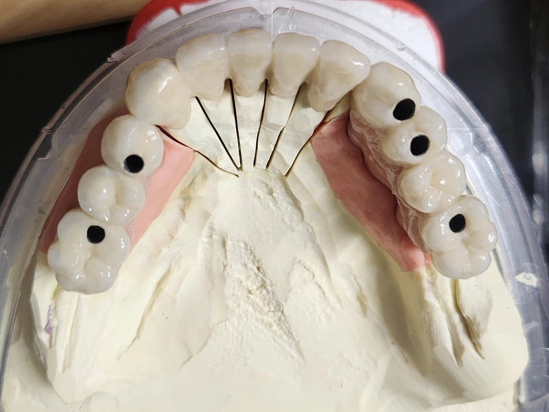 R&V Qualitätszahntechnik - Dentallabor - Anti-Schnarch-Mundstück