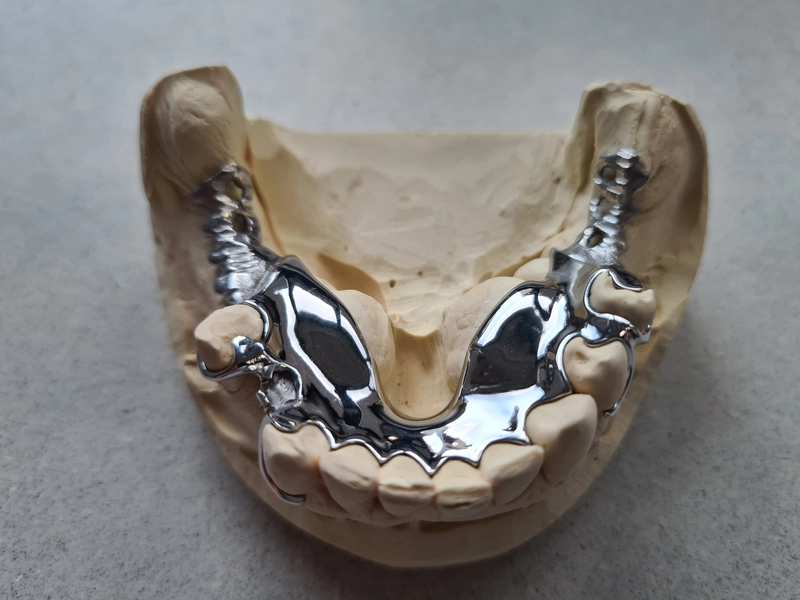 R&V Qualitätszahntechnik - Dentallabor - ein gegossenes Metallgerüst für eine herausnehmbare Teilprothese,