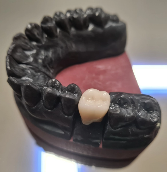 R&V Qualitätszahntechnik - Dentallabor - Anti-Schnarch-Mundstück